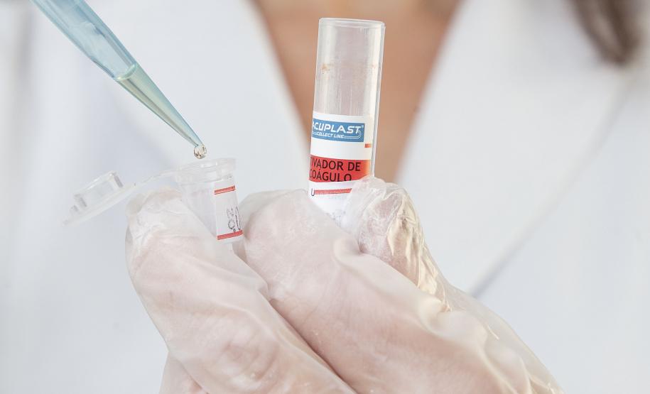 Em três anos, Tecpar atendeu viajantes de 39 países com serviço de sorologia antirrábica